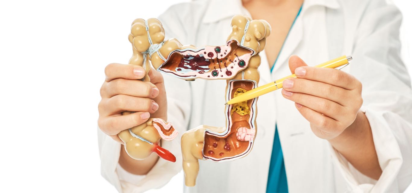 Coloproctología